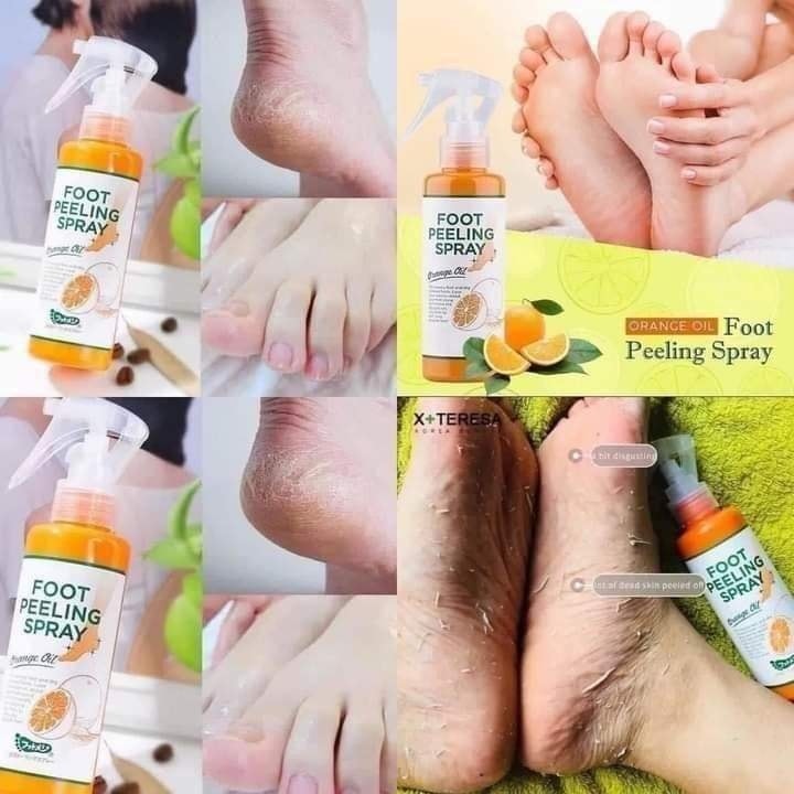 اسبراي القدم